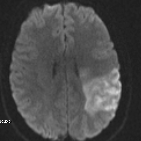 Cris_gomes_CT_scan_brain_stroke_okc.jpg