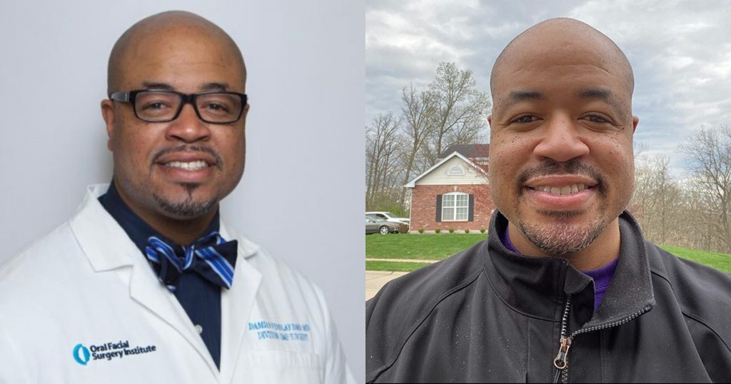 Dr. Damian Findlay before his COVID-19 battle (left) and the day he was released from the hospital (right).