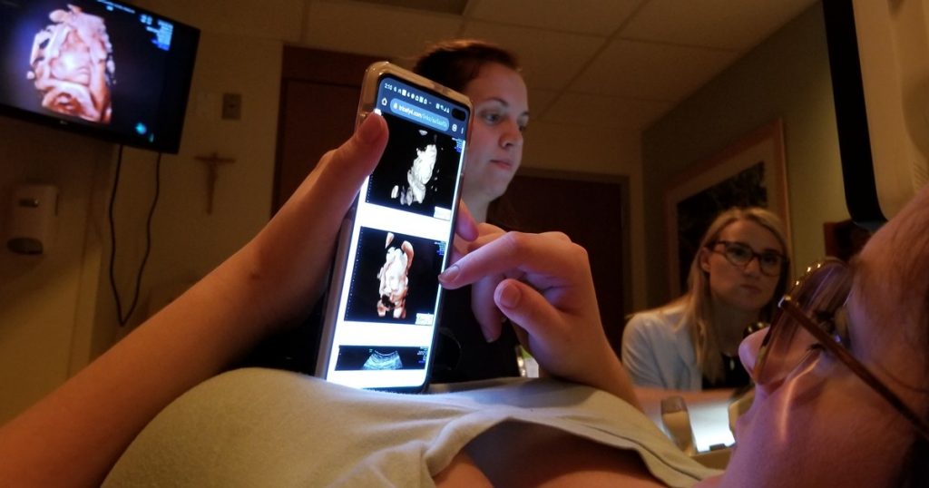 Meagan West looks at ultrasound images texted to her during her exam.