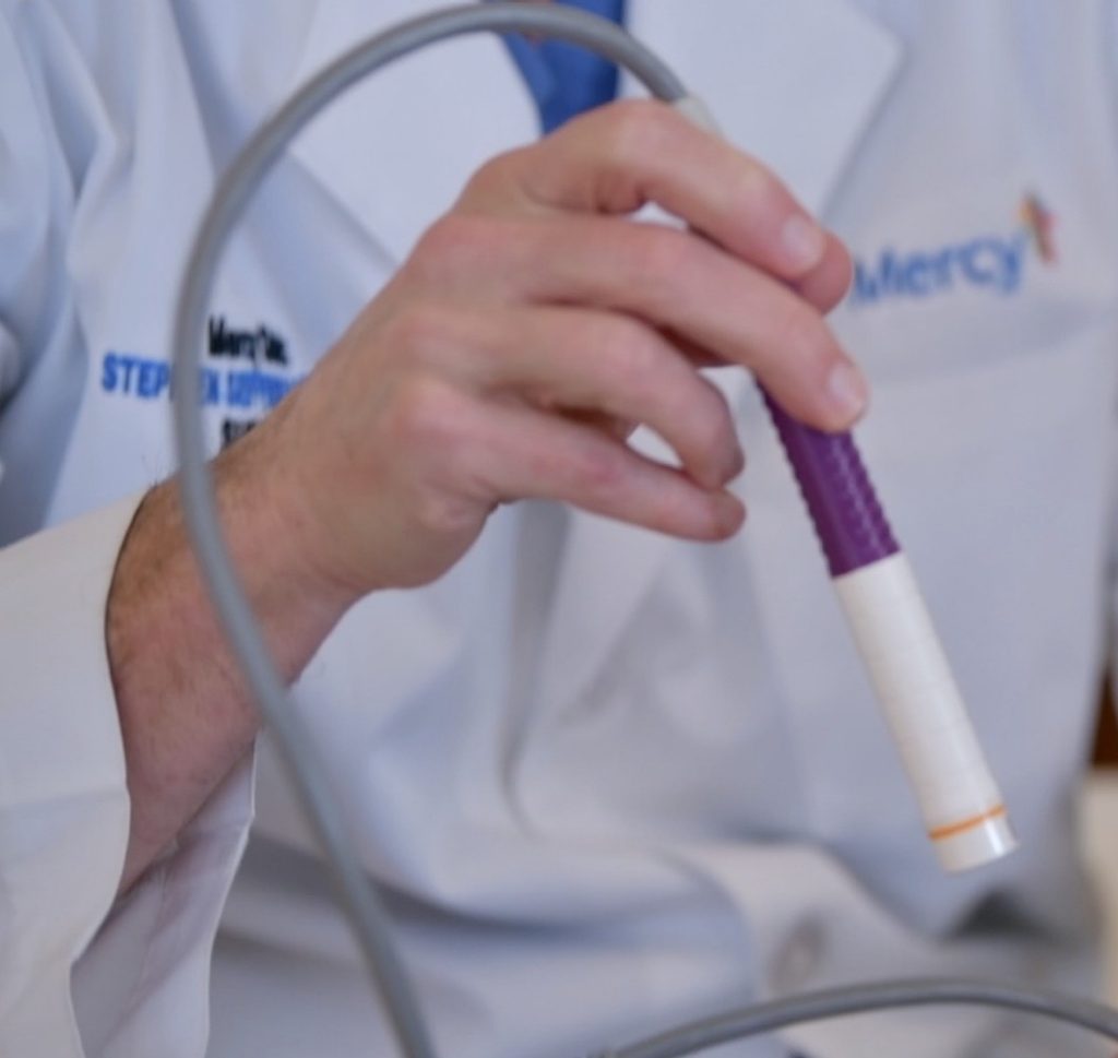 Dr. Stephen Seffense with Mercy Fort Smith demonstrates the SAVI SCOUT, a wireless device that eliminates the need for a pre-op procedure for patients undergoing a lumpectomy or surgical biopsy.