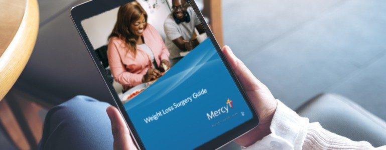 Mercy Weight Loss Surgery Guide